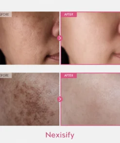 Nexisify 7% Arbutin + 4% Tranexamic Acid Dark Spot Cream