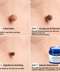 Nexisify® 7-Day Targeted Care for Skin Tags & Dark Spots