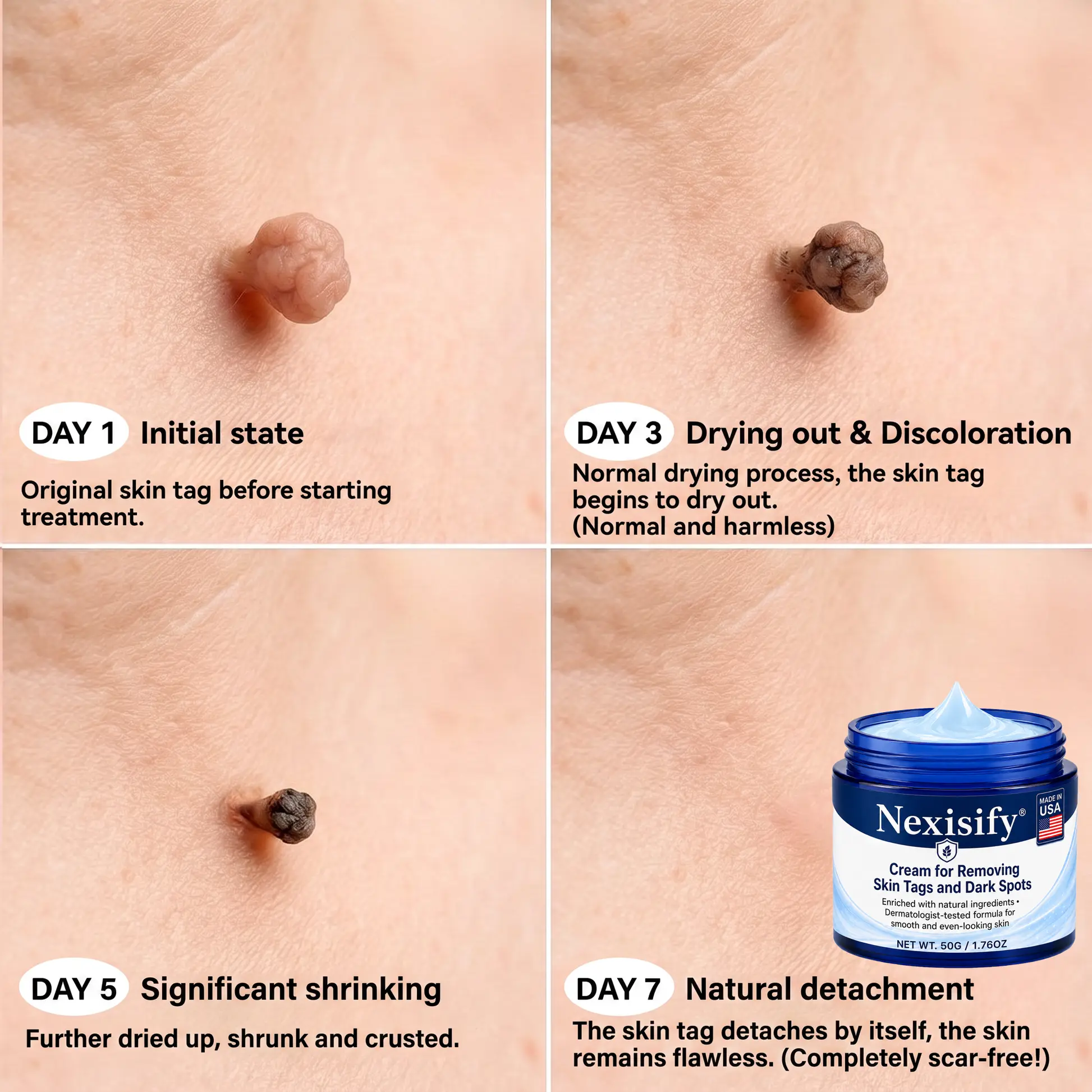 Nexisify® 7-Day Targeted Care for Skin Tags & Dark Spots